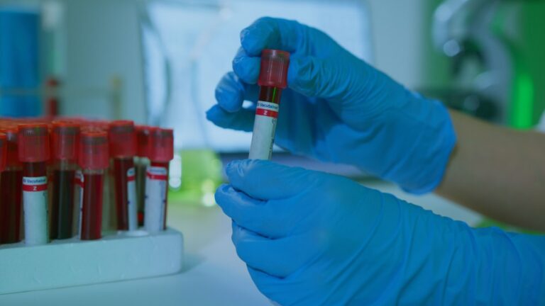 Mano con guante azul sujetando un tubo de muestra de sangre para analizar el grupo sanguíneo, con más tubos de ensayo en un laboratorio al fondo.